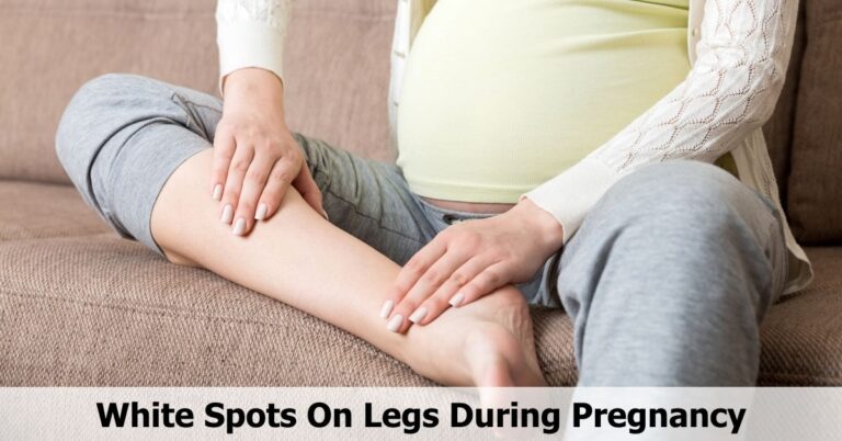 white-spots-on-legs-during-pregnancy-alarm-or-alas