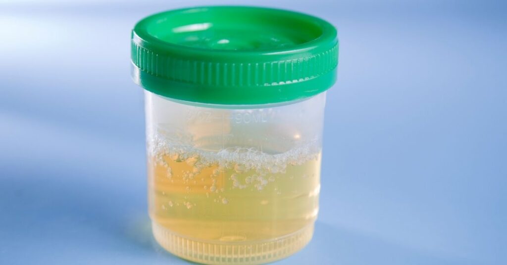 white stuff floating in my urine could i be pregnant (featured)