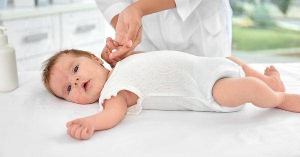 toddler skin reaction to ranch dressing