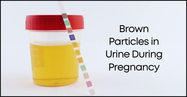 Brown Particles in Urine During Pregnancy