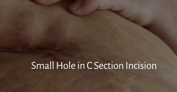 small hole in c section incision