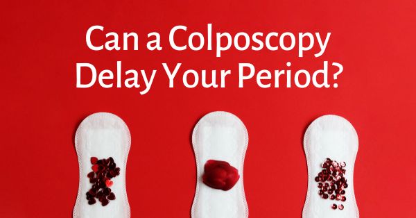 Can a Colposcopy Delay Your Period