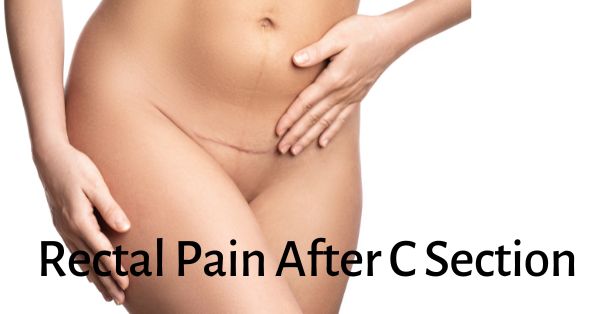 Rectal Pain After C Section