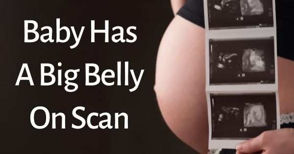 Baby Has A Big Belly On Scan