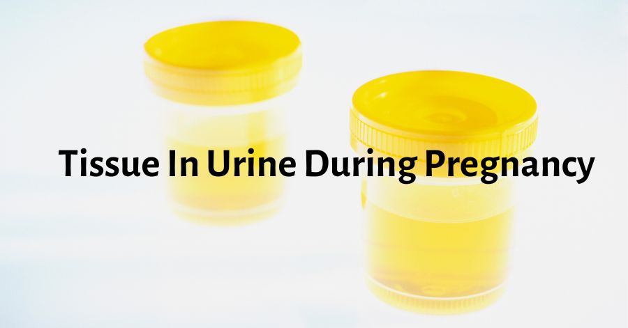 tissue-in-urine-during-pregnancy-should-i-be-worried