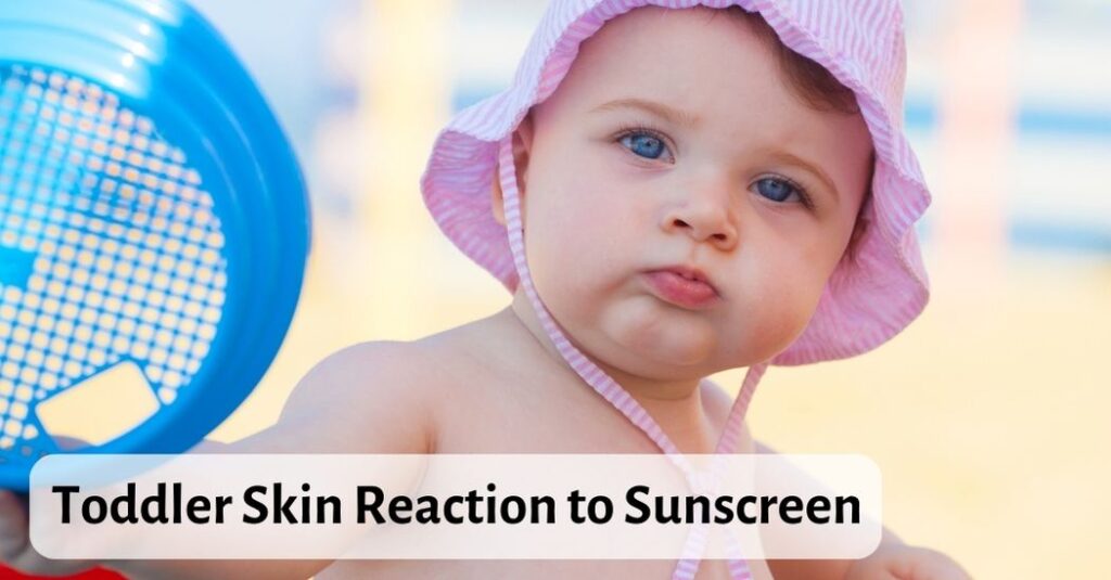 Toddler Skin Reaction to Sunscreen