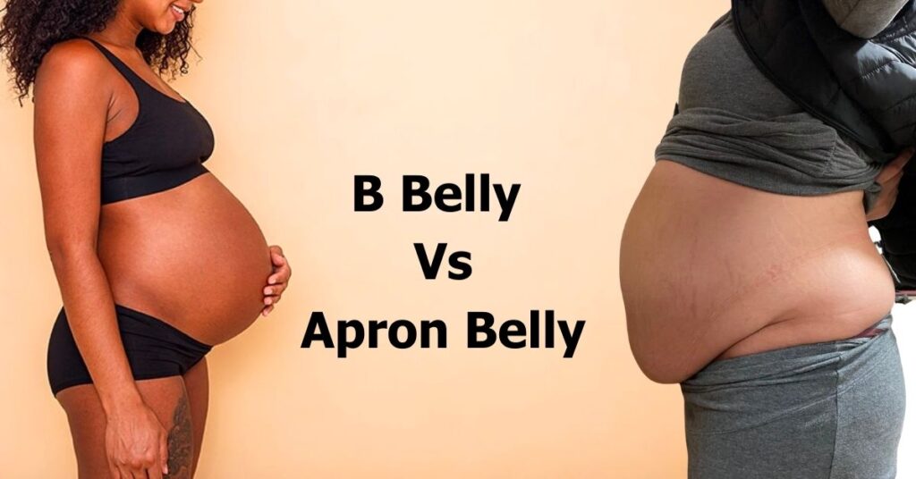 B Belly Vs Apron Belly