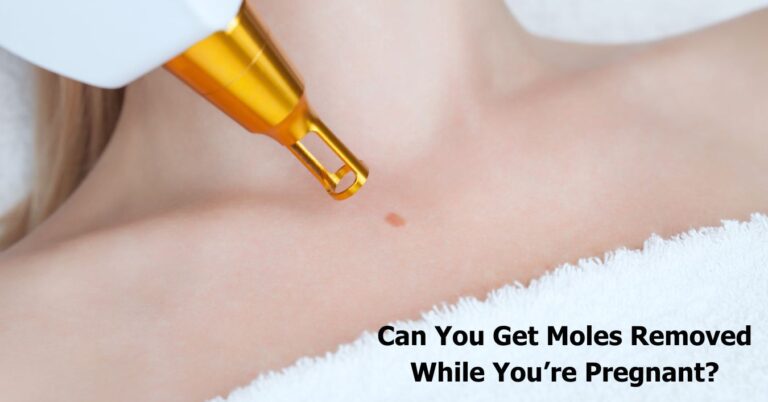 Can You Get A Mole Removed While Pregnant
