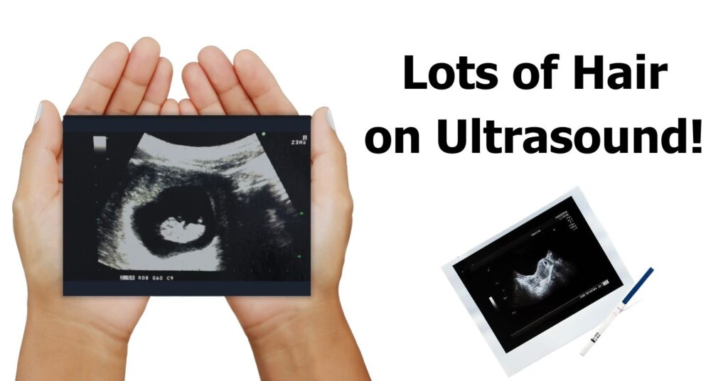 Lots of Hair on Ultrasound