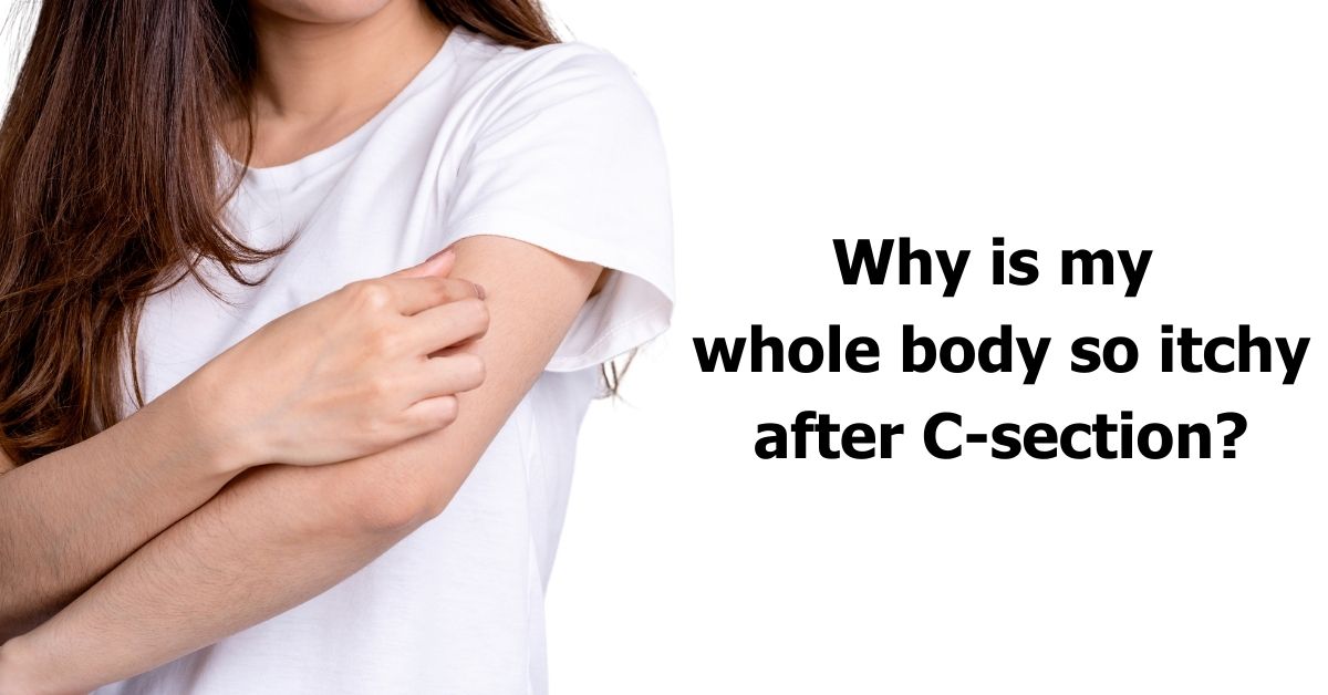 why-is-my-whole-body-so-itchy-after-c-section-causes-remedies