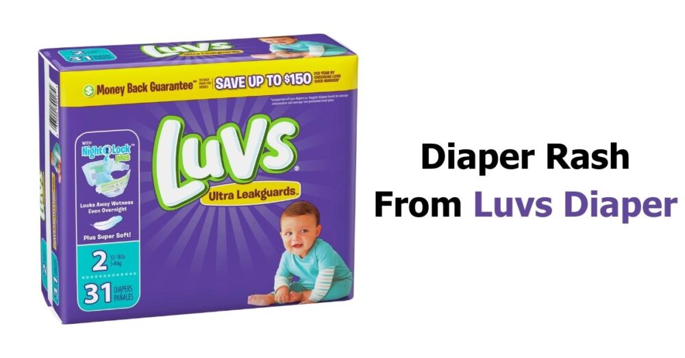 Diaper Rash From Luvs The Reasons & Effective Preventions