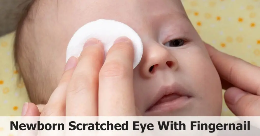 Newborn Scratched Eye With Fingernail