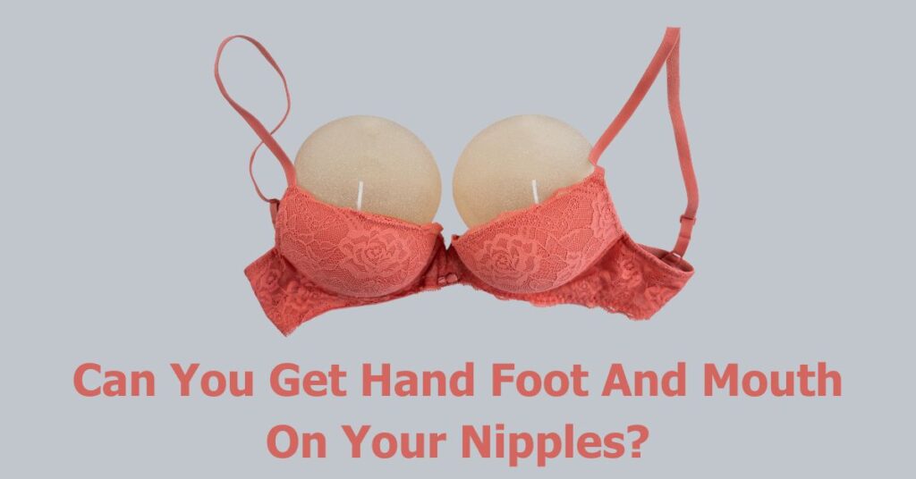 can-you-get-hand-foot-and-mouth-on-your-nipples