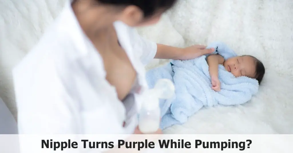 Nipple Turns Purple While Pumping