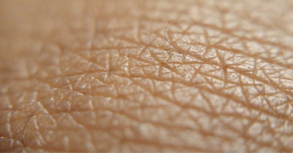 What Does Lye Do To Skin? The Real Damages