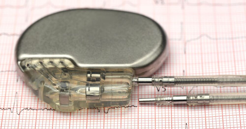Can A Pacemaker Cause Breast Pain? Pacemaker Warnings
