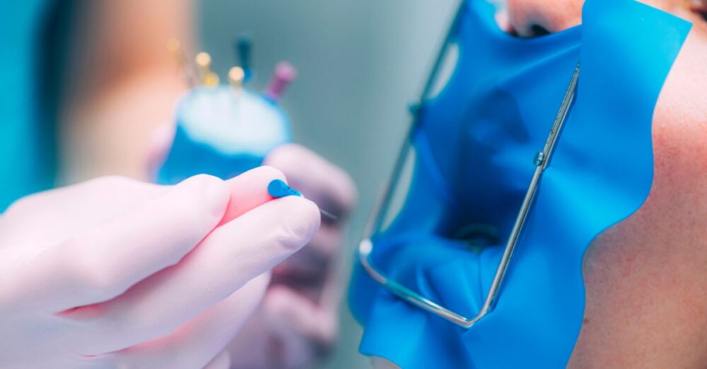 How Many Root Canals Can You Have On One Tooth? Capacity