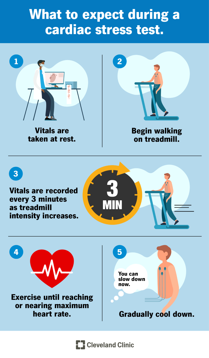 How Long Does A Treadmill Stress Test Take? Health Insights