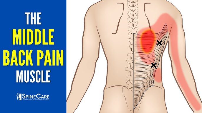 Back And Rib Pain Why Does My Rib Cage And Back Hurt? | Pain Relief Insights