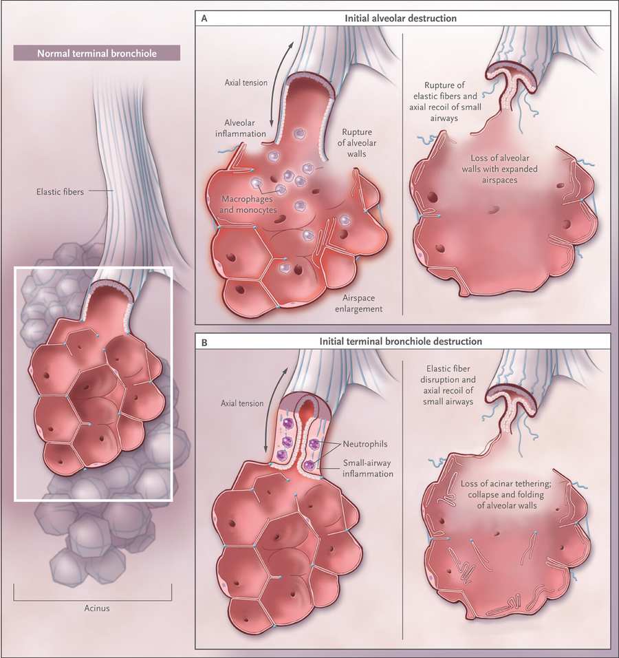 Lung parenchyma