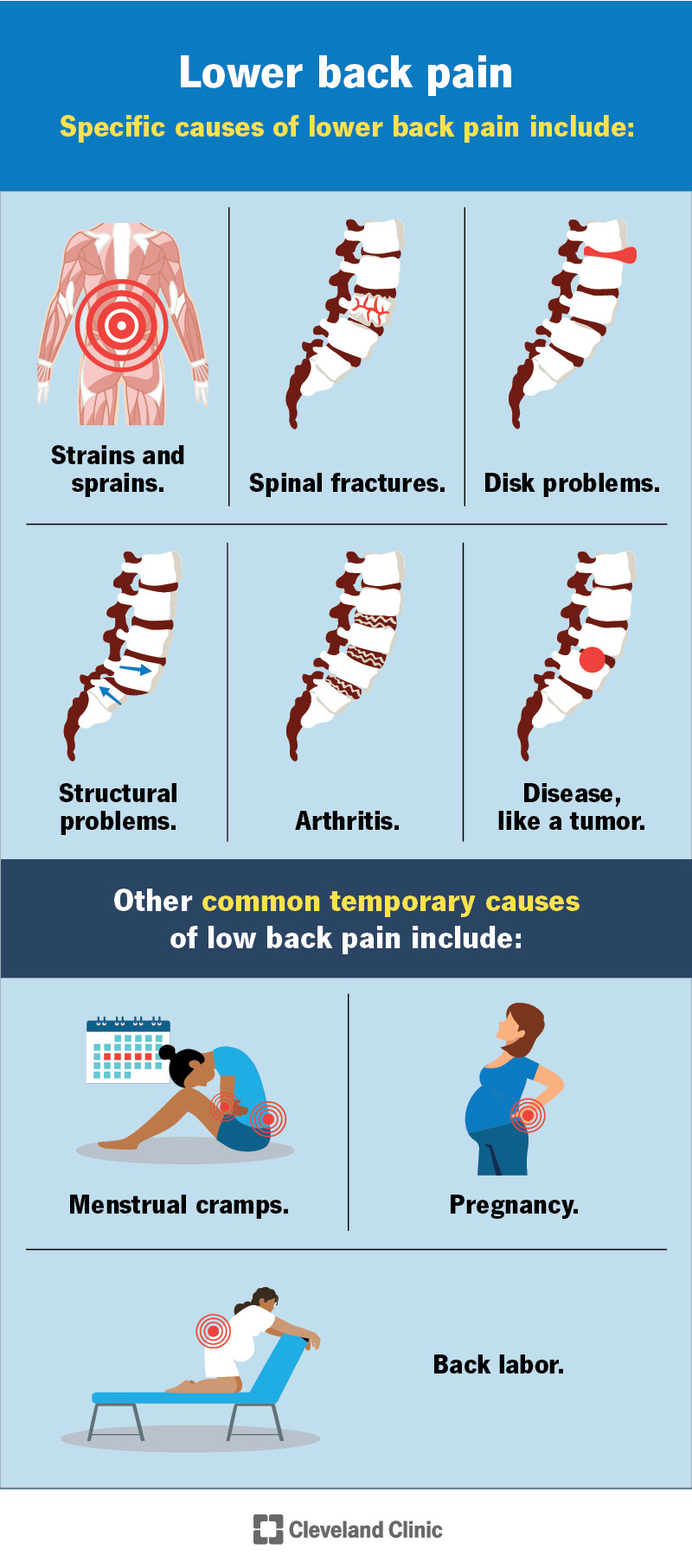 Does Lower Back Pain Mean Labor Expecting Insights does-lower-back-pain-mean-labor-expecting-insights
